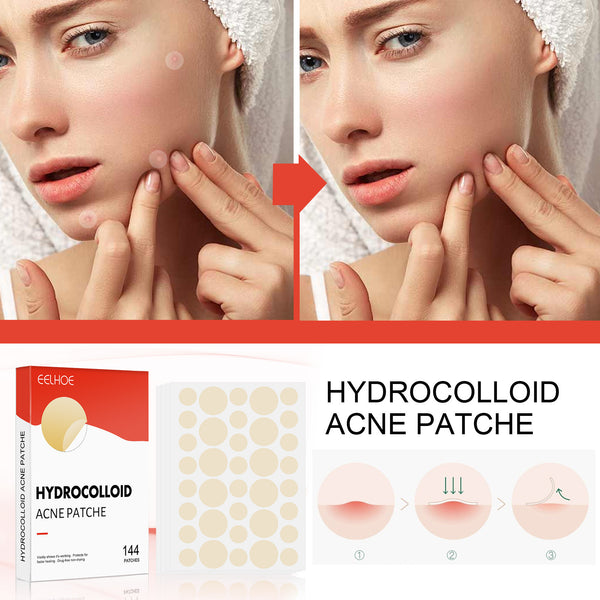 Eelhoe Hydrocolloid Acne Patch Invisible Makeup Closed